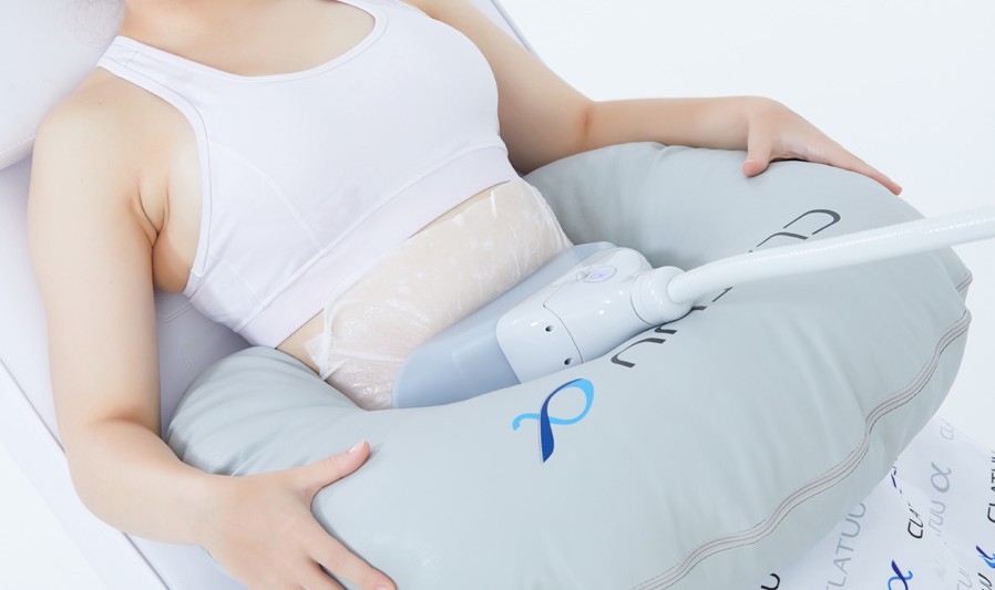 Fat Freezing on Abdomen