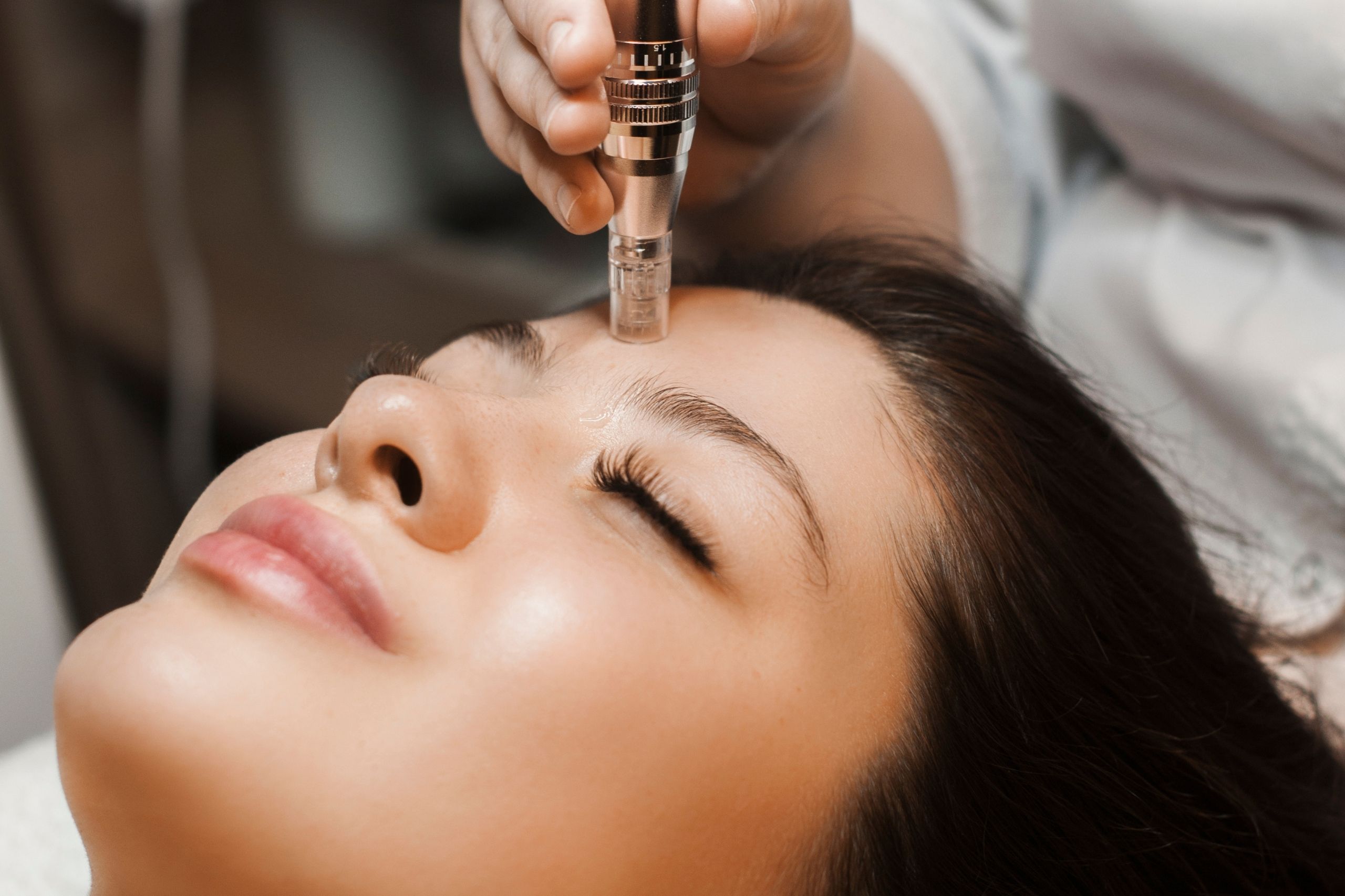 Microneedling Atlanta