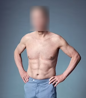 EF MEDISPA Emsculpt NEO Client Result